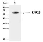 RNF25 Antibody in Immunoprecipitation (IP)