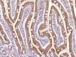 ROGDI Polyclonal Antibody