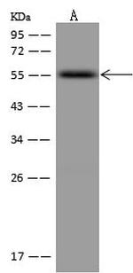 RXRB Polyclonal Antibody