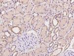 ACN9 Polyclonal Antibody