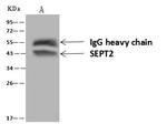 SEPT2 Antibody in Immunoprecipitation (IP)