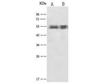 alpha-1 Antitrypsin Polyclonal Antibody
