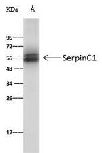 SERPINC1 Antibody in Immunoprecipitation (IP)