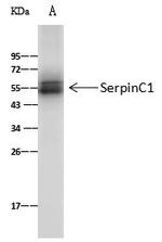 SERPINC1 Antibody in Immunoprecipitation (IP)