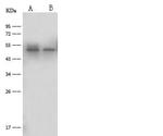 SERPINC1 Antibody in Western Blot (WB)