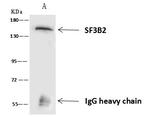 SF3B2 Antibody in Immunoprecipitation (IP)