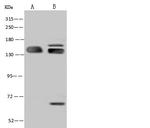 SF3B2 Antibody in Western Blot (WB)