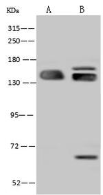 SF3B2 Antibody in Western Blot (WB)