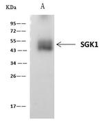 SGK1 Antibody in Immunoprecipitation (IP)