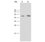 SGK1 Polyclonal Antibody