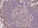 SH3KBP1 Polyclonal Antibody