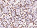 SH3KBP1 Antibody in Immunohistochemistry (Paraffin) (IHC (P))