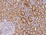 ORNT1 Polyclonal Antibody