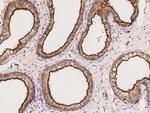 EBP50 Polyclonal Antibody
