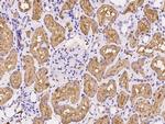 EBP50 Antibody in Immunohistochemistry (Paraffin) (IHC (P))