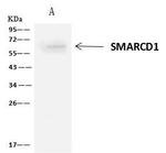 SMARCD1 Antibody in Immunoprecipitation (IP)