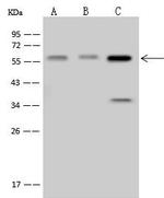 SMARCD1 Antibody in Western Blot (WB)
