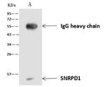 SNRPD1 Antibody in Immunoprecipitation (IP)