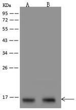 SNRPD1 Antibody in Western Blot (WB)