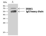 SNW1 Antibody in Immunoprecipitation (IP)