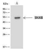 SNX8 Antibody in Immunoprecipitation (IP)