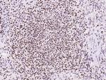 SP4 Antibody in Immunohistochemistry (Paraffin) (IHC (P))