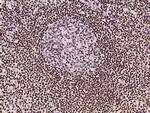 SP4 Antibody in Immunohistochemistry (Paraffin) (IHC (P))