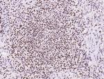 SP4 Antibody in Immunohistochemistry (Paraffin) (IHC (P))