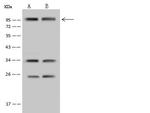SP4 Antibody in Western Blot (WB)
