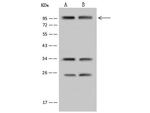 SP4 Antibody in Western Blot (WB)