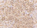 Spastin Polyclonal Antibody
