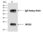 SPCS2 Antibody in Immunoprecipitation (IP)