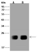 SPCS2 Polyclonal Antibody