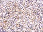 SRM Antibody in Immunohistochemistry (Paraffin) (IHC (P))