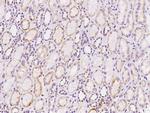 SRM Antibody in Immunohistochemistry (Paraffin) (IHC (P))