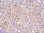 SRM Antibody in Immunohistochemistry (Paraffin) (IHC (P))