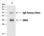 SRM Antibody in Immunoprecipitation (IP)