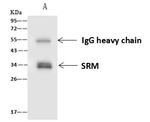 SRM Antibody in Immunoprecipitation (IP)