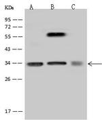 SRM Antibody in Western Blot (WB)