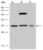 SRM Antibody in Western Blot (WB)