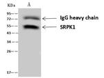 SRPK1 Antibody in Immunoprecipitation (IP)