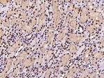 SSB Polyclonal Antibody