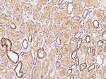 HIP Antibody in Immunohistochemistry (Paraffin) (IHC (P))