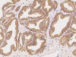 HIP Polyclonal Antibody