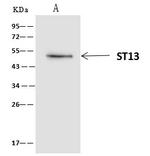 HIP Antibody in Immunoprecipitation (IP)