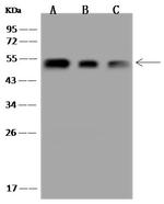 HIP Antibody in Western Blot (WB)
