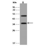 STAP1 Polyclonal Antibody