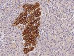 MUNC18 Antibody in Immunohistochemistry (Paraffin) (IHC (P))