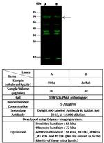 MUNC18 Antibody in Western Blot (WB)