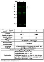 MUNC18 Antibody in Western Blot (WB)